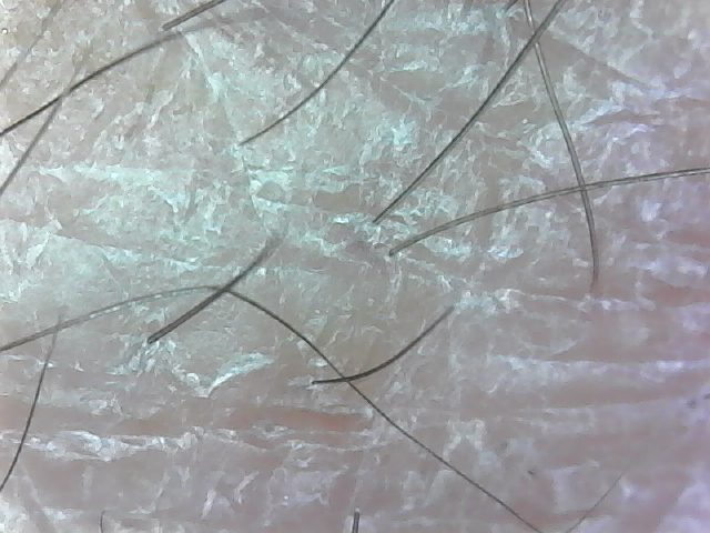 Hairs on my hand